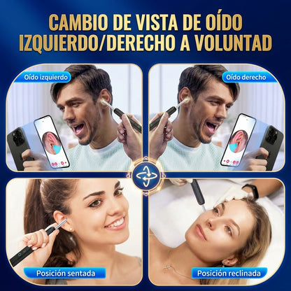 AurisMAX™| Limpiador De Oidos CON CAMARA📸🪛